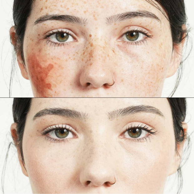 https://cdn.shopify.com/s/files/1/0493/4592/1183/files/hide_beforeafter_square_2_-_Large_540p.mp4?v=1603389128